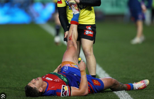 Pickle Juice for Cramps in Rugby Players